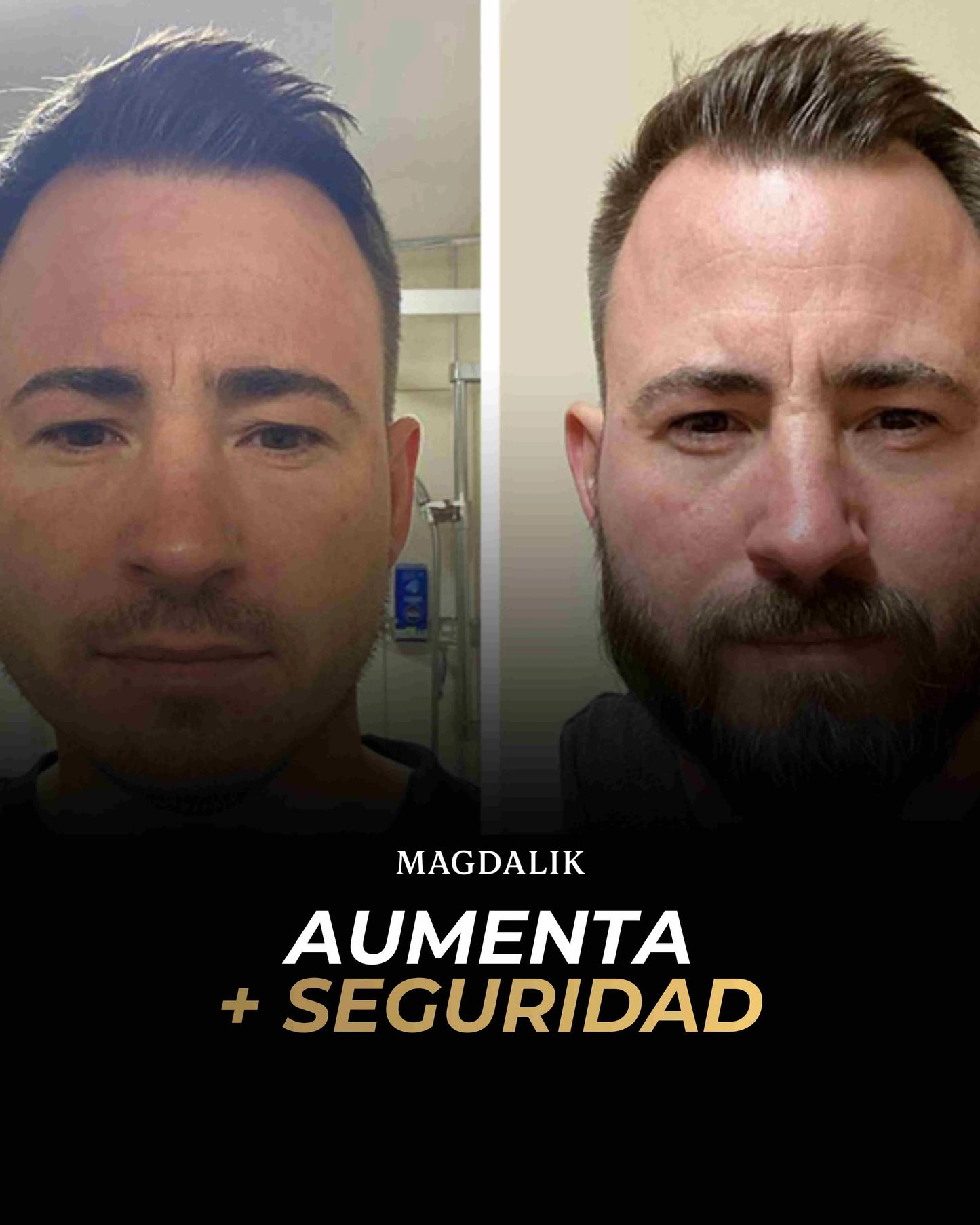 Aceite Capilar Engrosador Pro